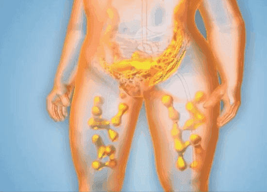 1703921739225428.gif