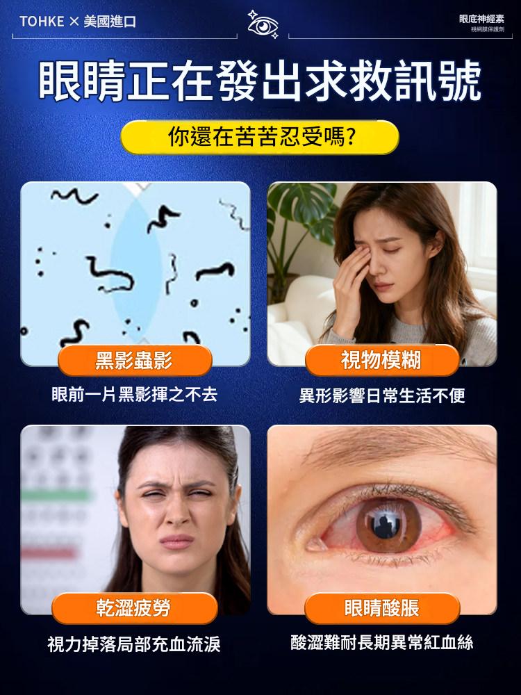 【銷售10W+】進口葉黃素保護眼膠囊視力疲勞中老年成人專用官方旗艦店原廠正品 【銷售10W+】進口葉黃素保護眼膠囊視力疲勞中老年成人專用官方旗艦店原廠正品